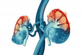 Des biomarqueurs non invasifs dans la fibrose rénale ?